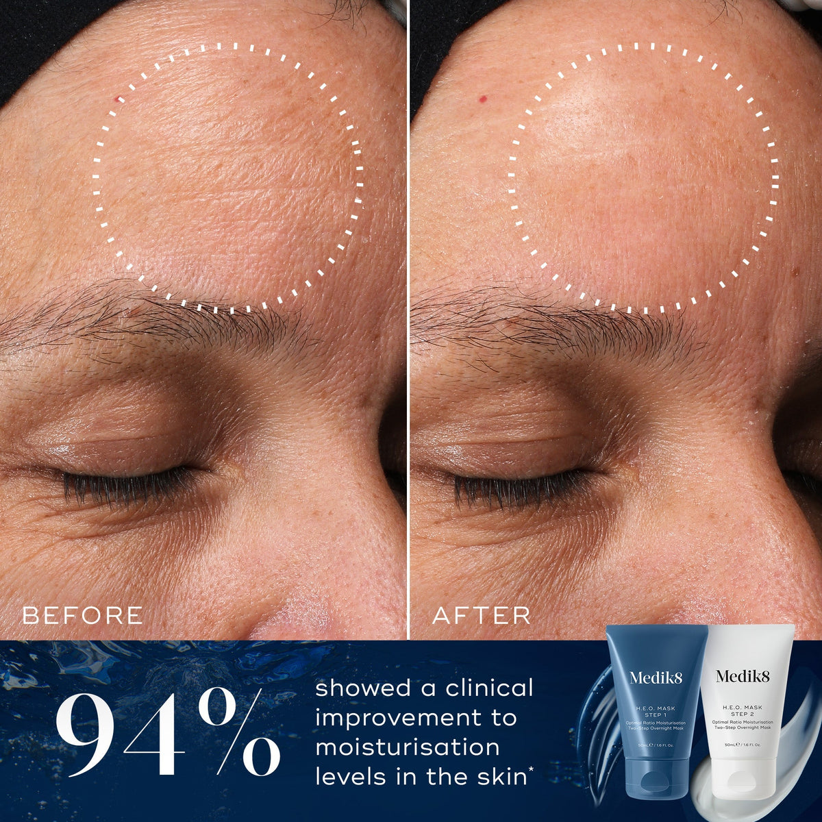 Medik8 H.E.O. Mask visible results from Medik8 UK