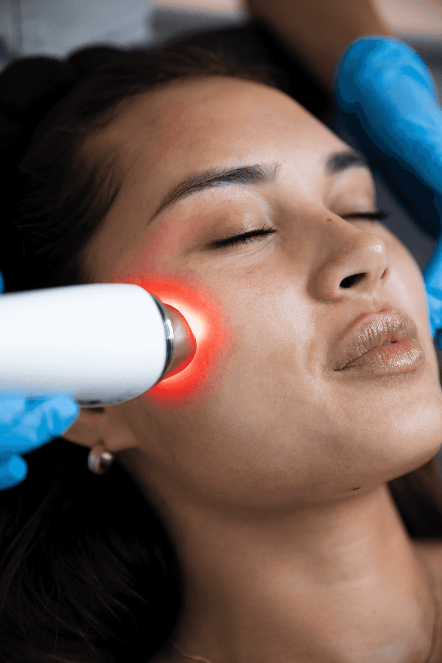 Clearer Skin Starts Here: Your Guide to Acne and Acne Scarring