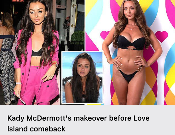 Kady McDermott, 27, underwent £1,000 makeover including five-minute nose job, filler, and Botox before returning to Love Island seven years after her first appearance