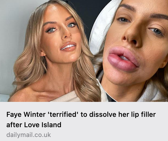 Faye Winter on being 'terrified' to dissolve her lip filler after Love Island and wanting to front doc about injectable dangers