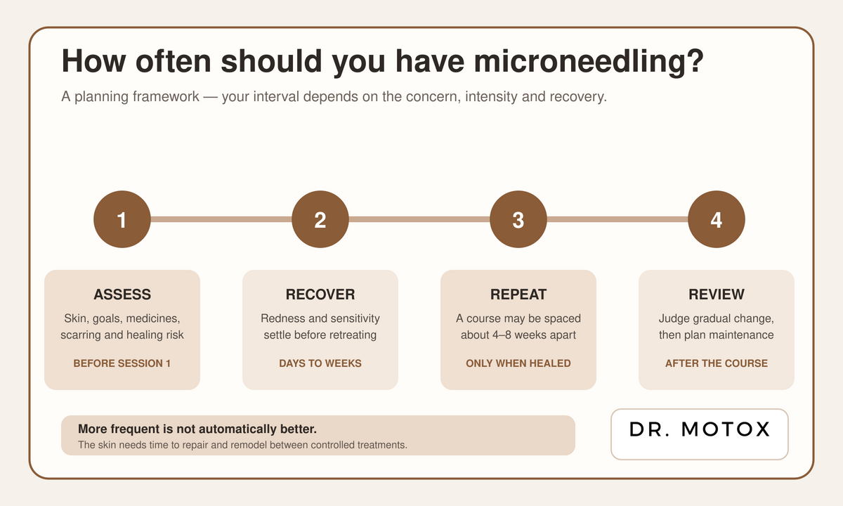 Microneedling treatment timeline showing assessment, recovery, repeat sessions and review