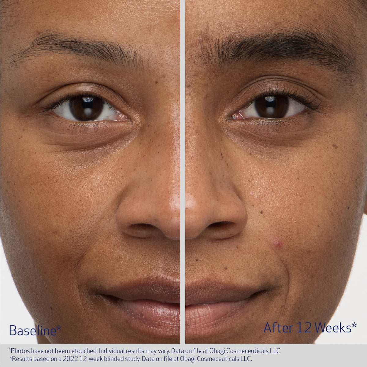 Obagi Nu-Cil eyebrow boosting serum bottle with before and after images showing improved eyebrow fullness and growth.
