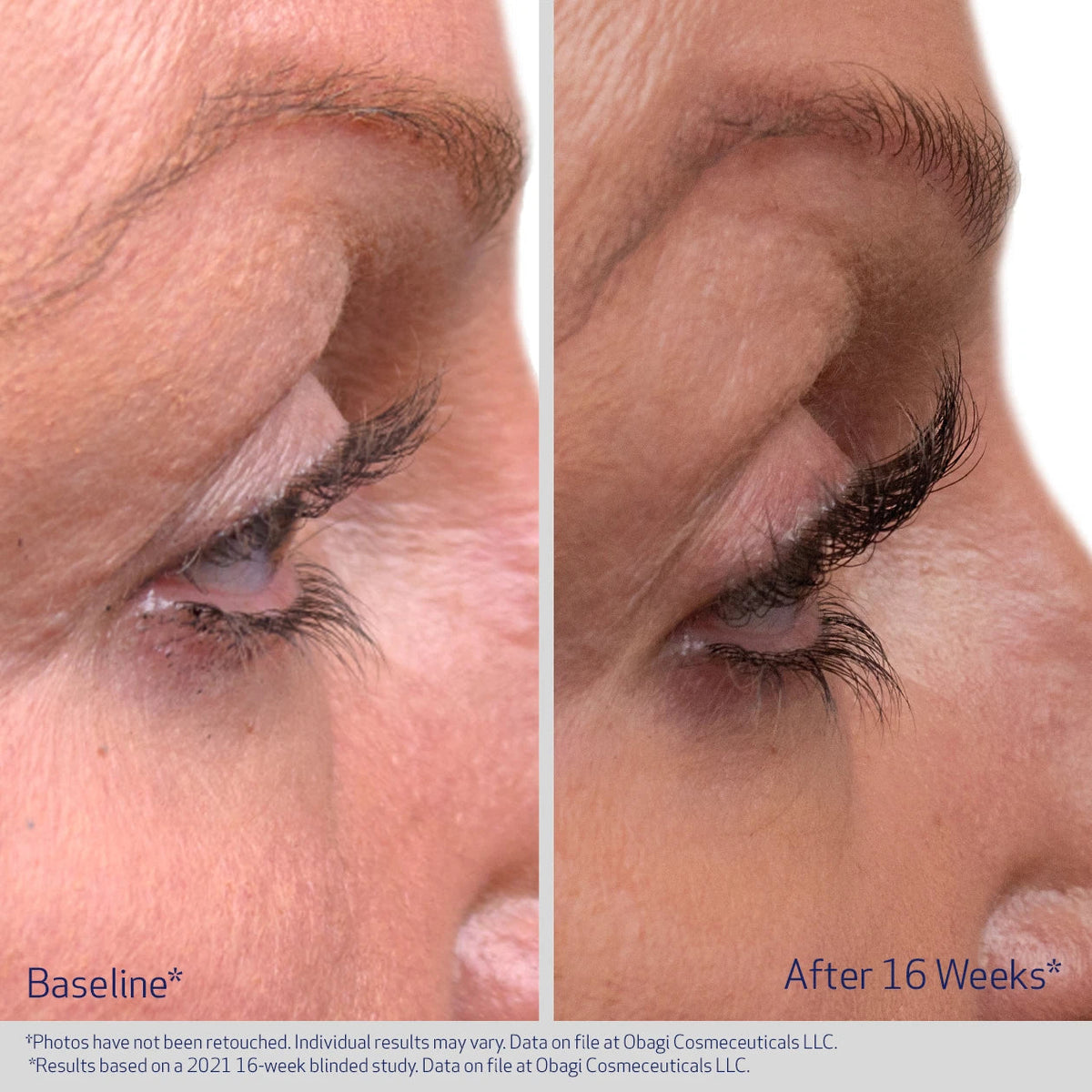 Obagi Nu-Cil eyelash enhancing serum bottle with before and after lash images showing improved lash length and fullness.