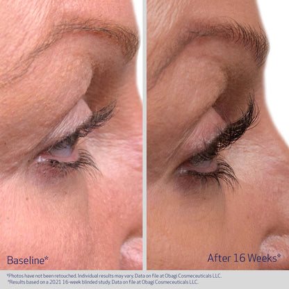 Obagi Nu-Cil eyelash enhancing serum bottle with before and after lash images showing improved lash length and fullness.