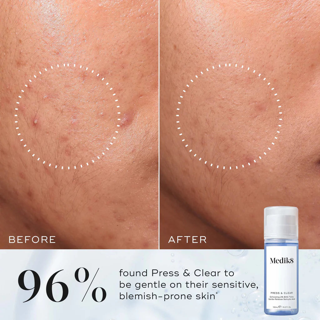 Medik8 Press &amp; Clear™ Exfoliating BHA Toner – 2% Salicylic Acid, 150 ml