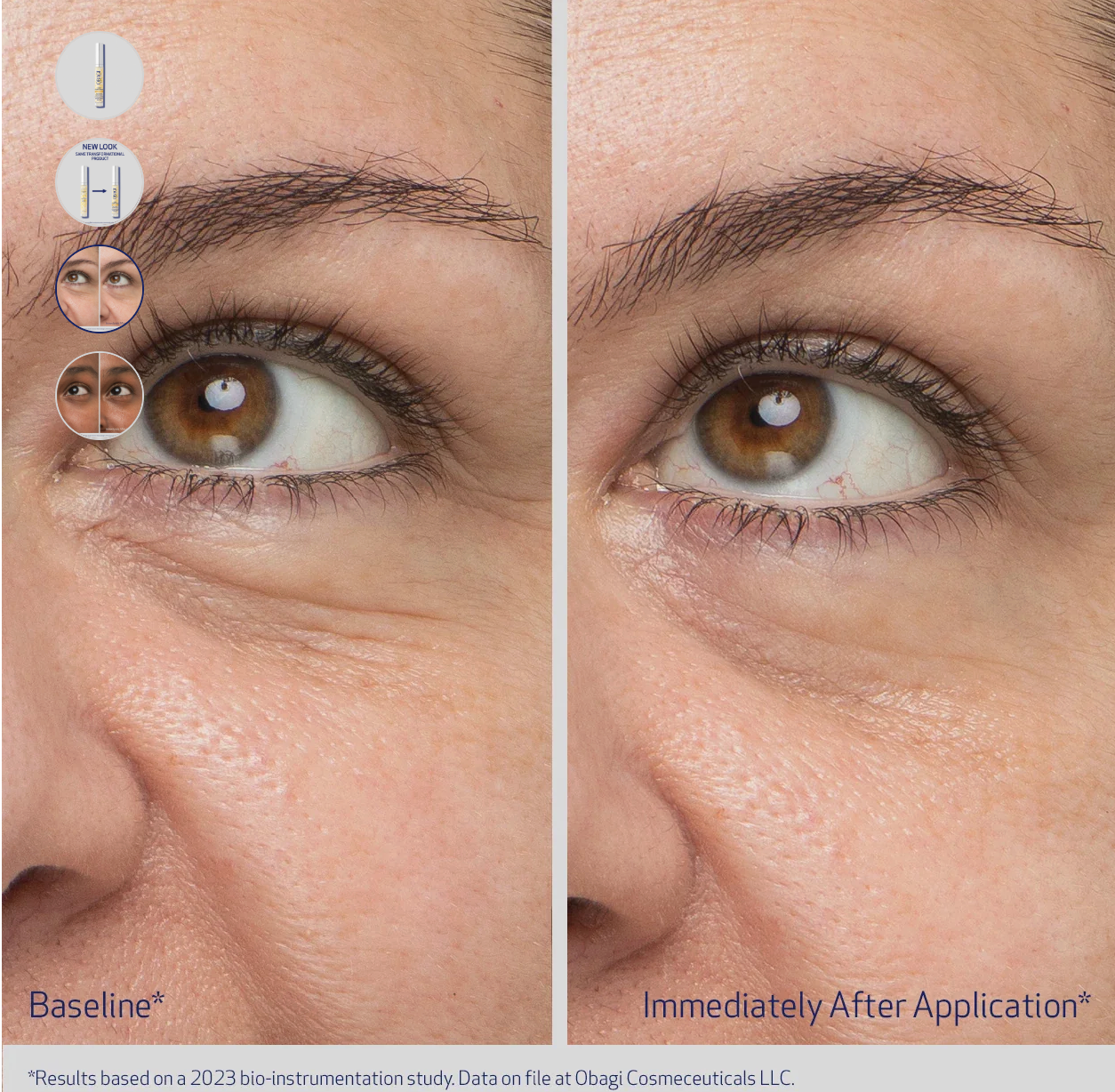Obagi Daily Hydro-Drops Rejuvenating Eye Gel Cream with hydrating formula for fine lines and puffiness around the eyes.