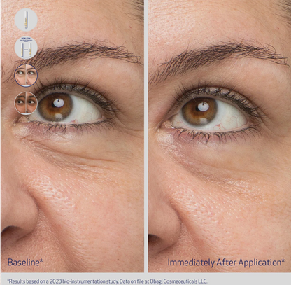 Obagi Daily Hydro-Drops Rejuvenating Eye Gel Cream with hydrating formula for fine lines and puffiness around the eyes.