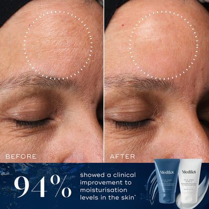 Medik8 H.E.O. Mask visible results from Medik8 UK