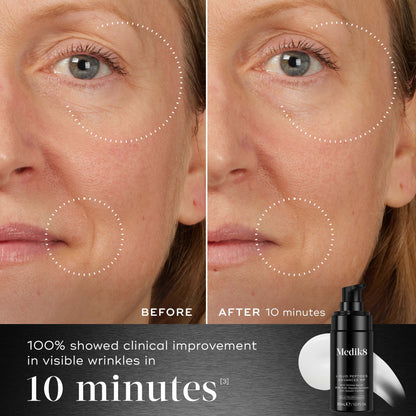 Liquid Peptides Advanced MP visible results from Medik8 UK