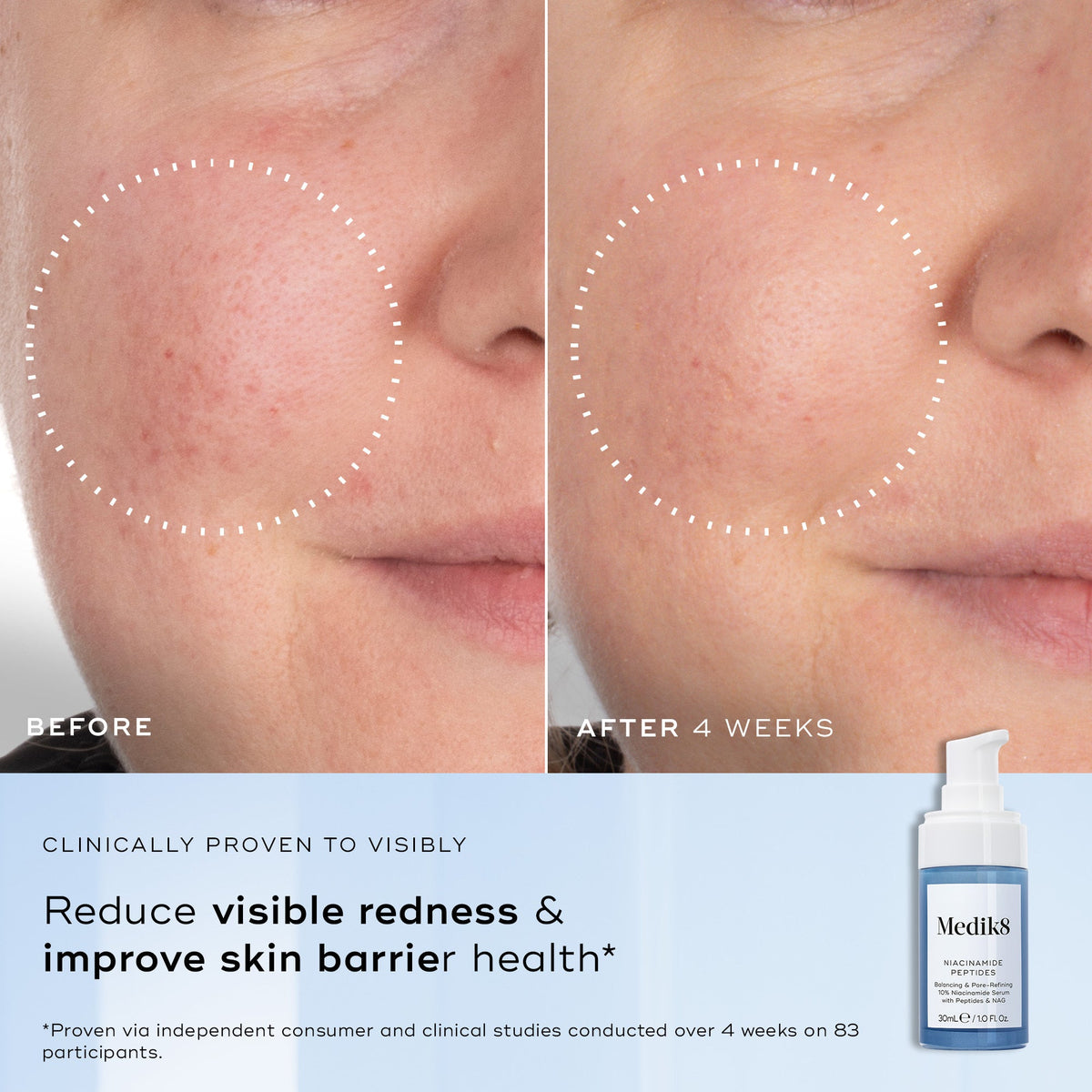 Niacinamide Peptides official UK image 4