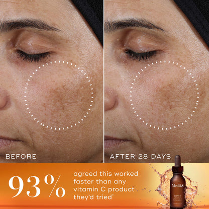 Super C Ferulic™ official UK image 3