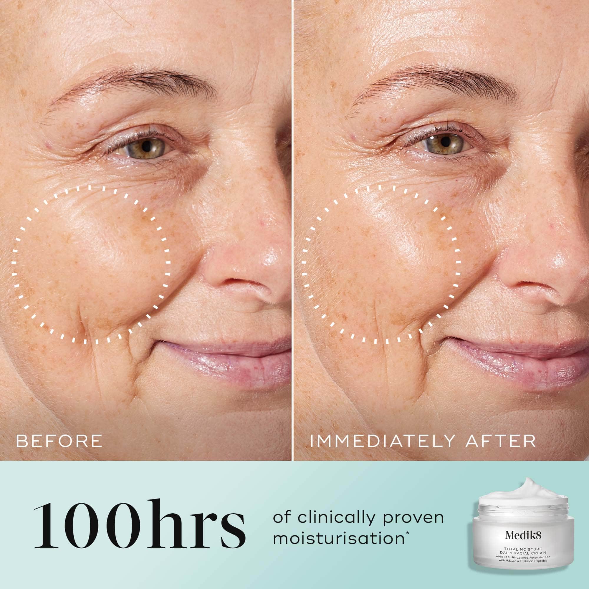 Medik8 Total Moisture Daily Facial Cream | Deep Hydration Moisturiser