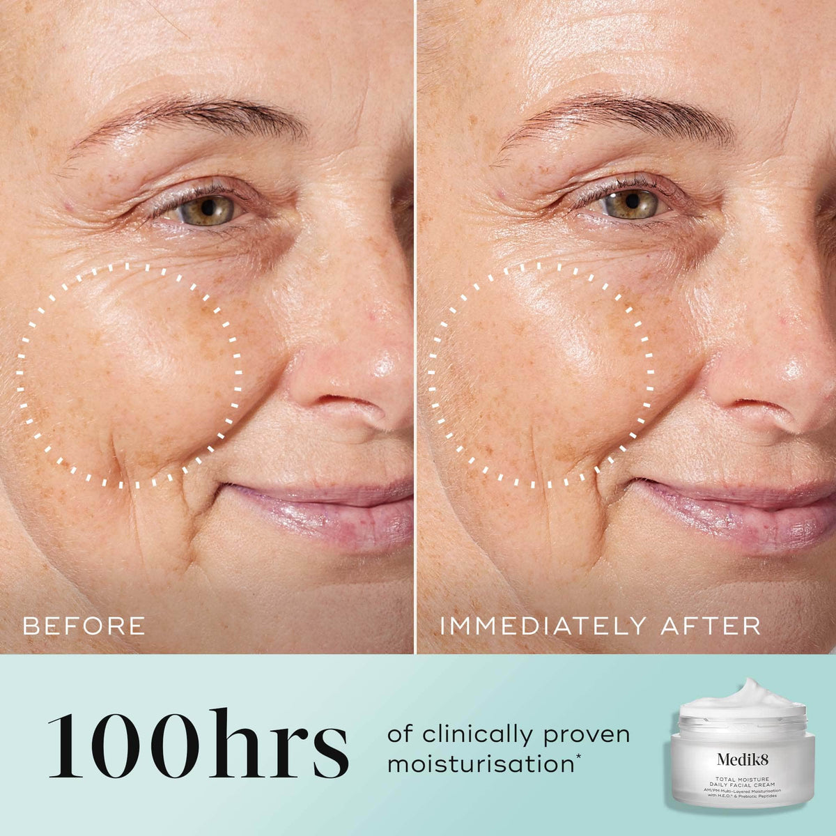 Total Moisture Daily Facial Cream™ official UK image 4
